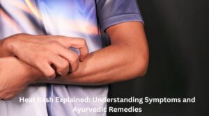 Heat Rash Explained Understanding Symptoms and Ayurvedic Remedies